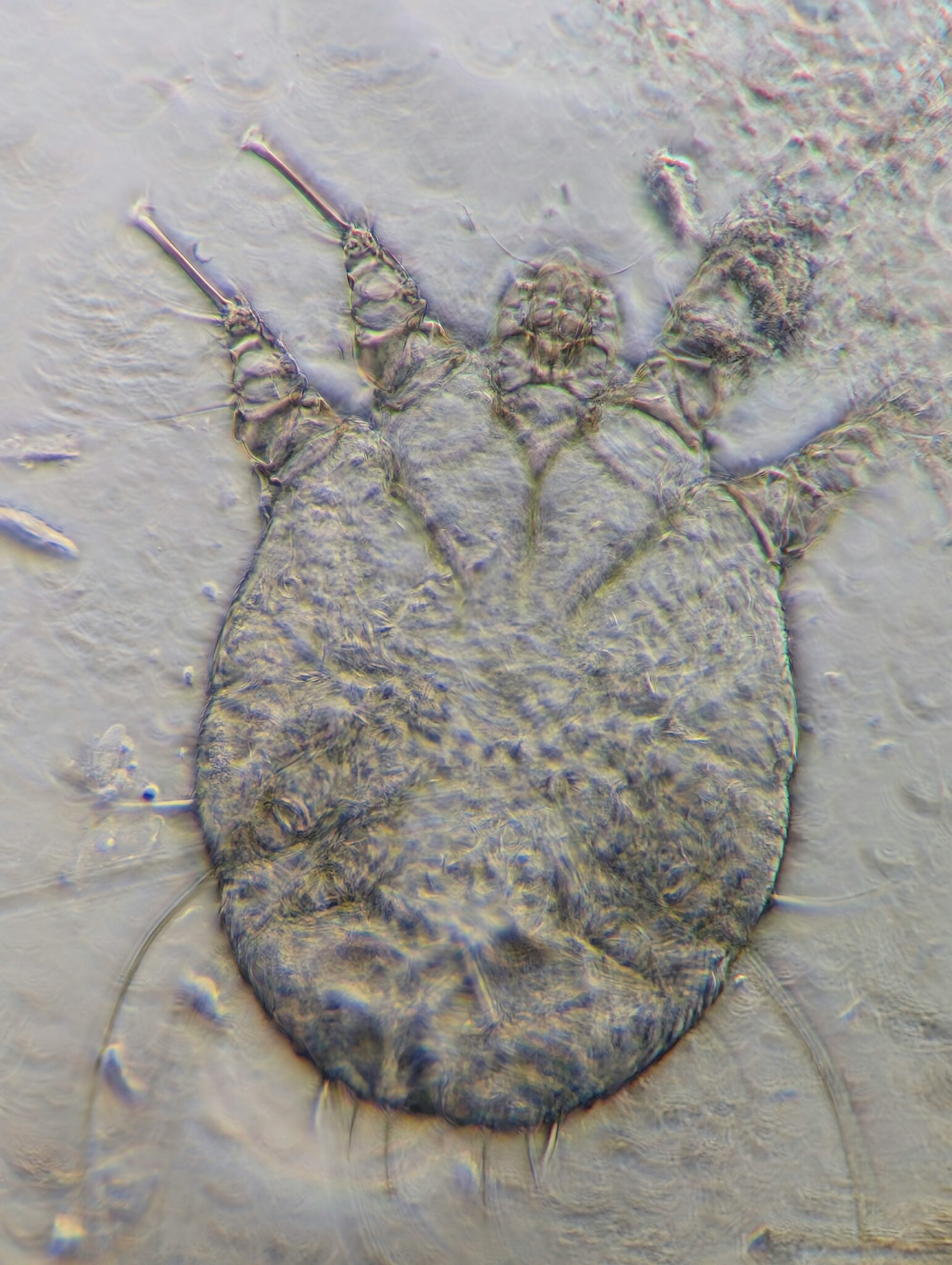 Ticks