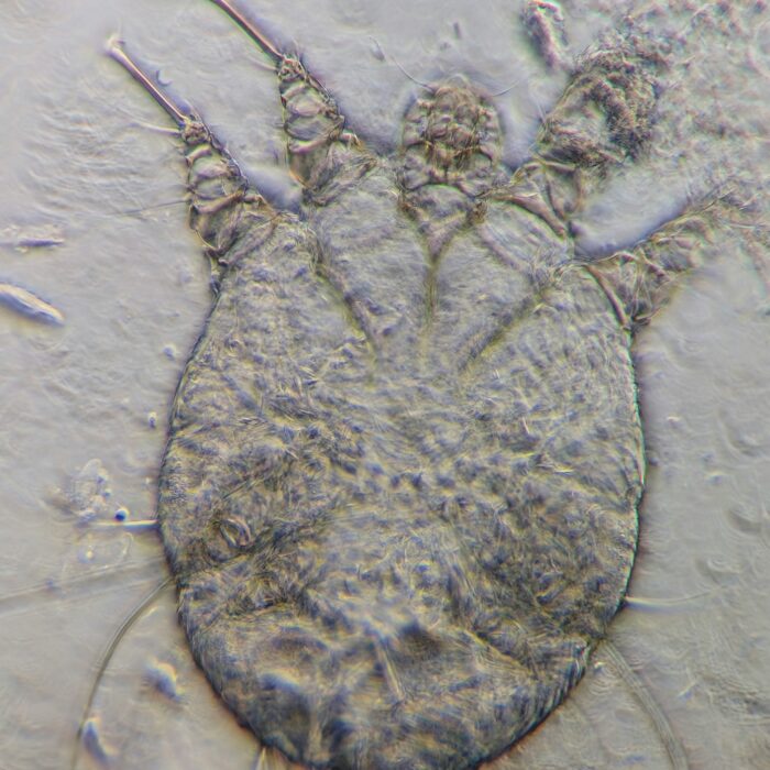 Microscopic close-up of a tick showing its body and legs against a pale background.